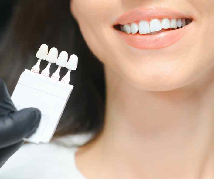 Dentist preparing and applying dental veneers