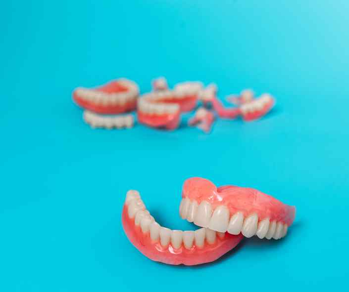 Full and partial dentures displayed on a dental model