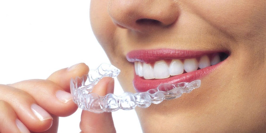 Invisalign St. Albert